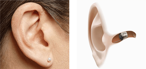 Aparaty słuchowe kompletnie niewidoczne (IIC)