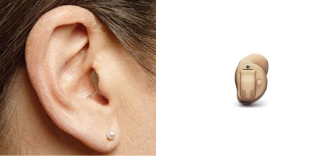 Aparaty słuchowe typu CIC, które są dyskretne i umieszczone w kanale słuchowym, są zgodne z telefonami komórkowymi.